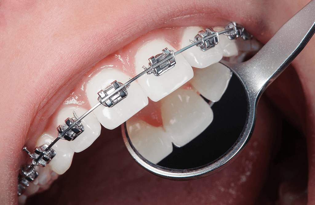 ortodontie bacau